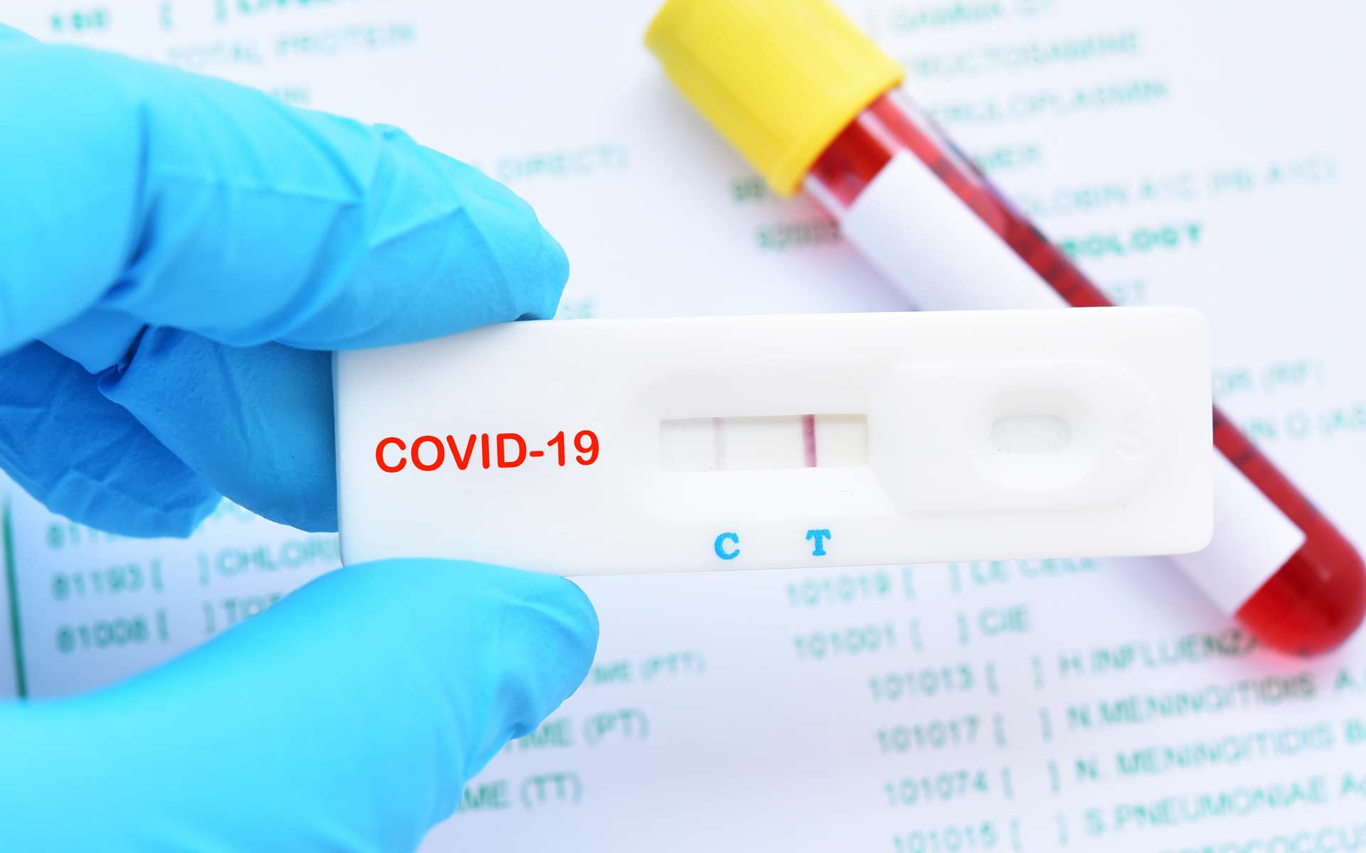 covid-19-test